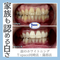 画像1181