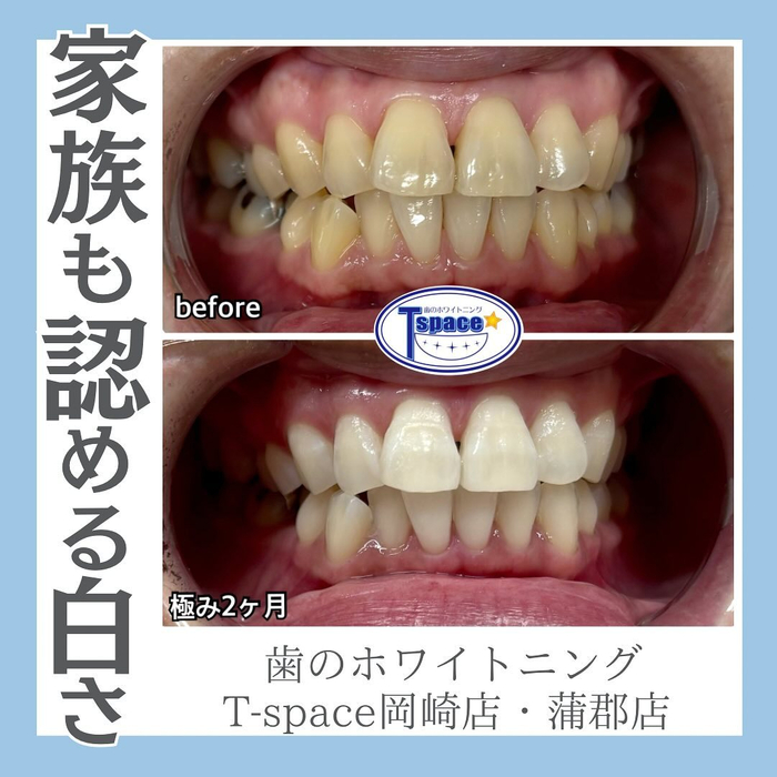 画像1181