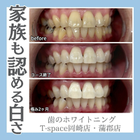画像1182