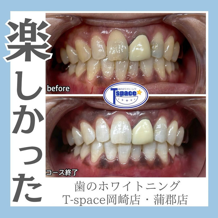 画像1188