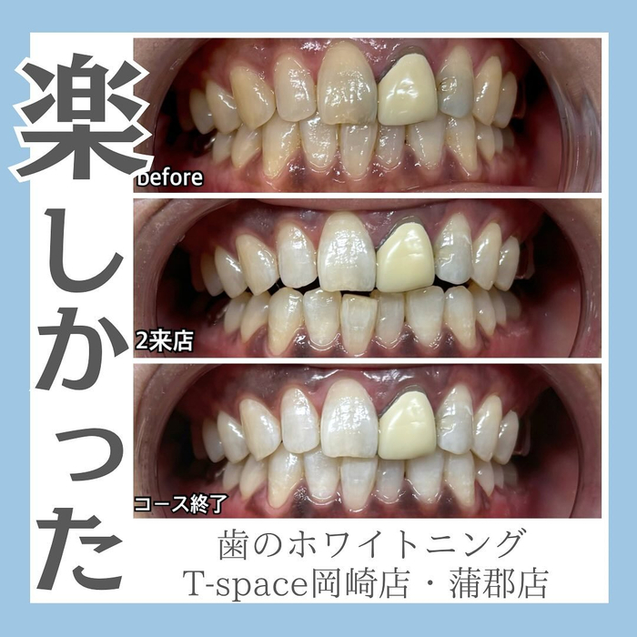 画像1189
