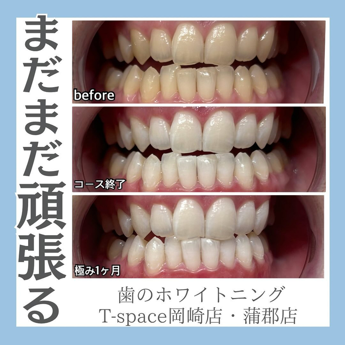 画像1198