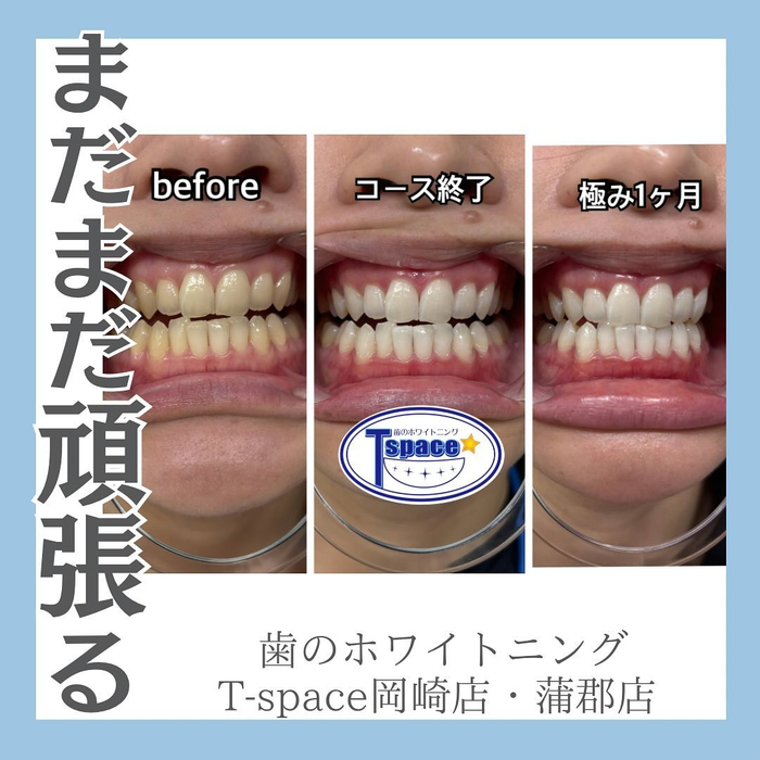 画像1199