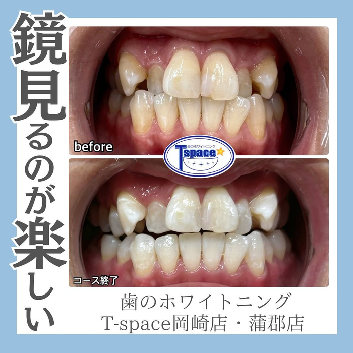 画像1205