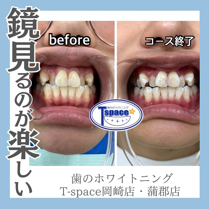 画像1207