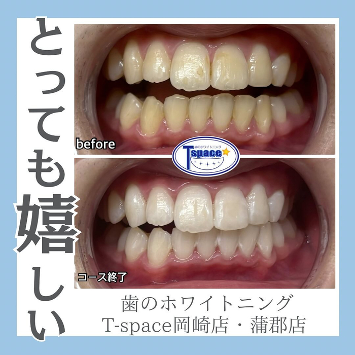 画像1215