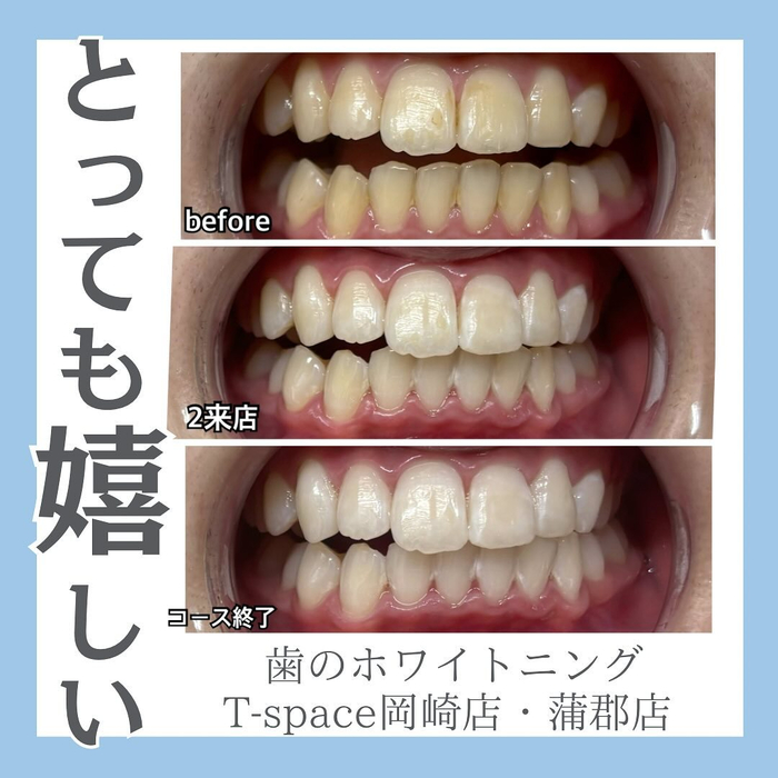 画像1216