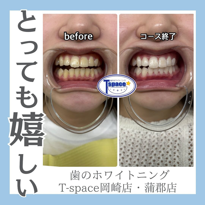 画像1217