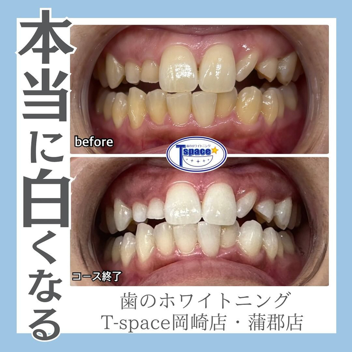 画像1225