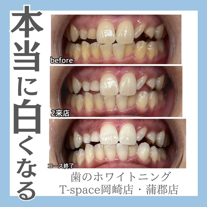画像1226