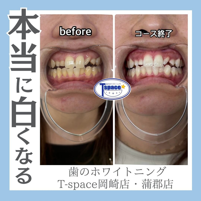 画像1227