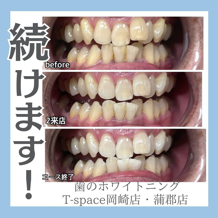 画像1236