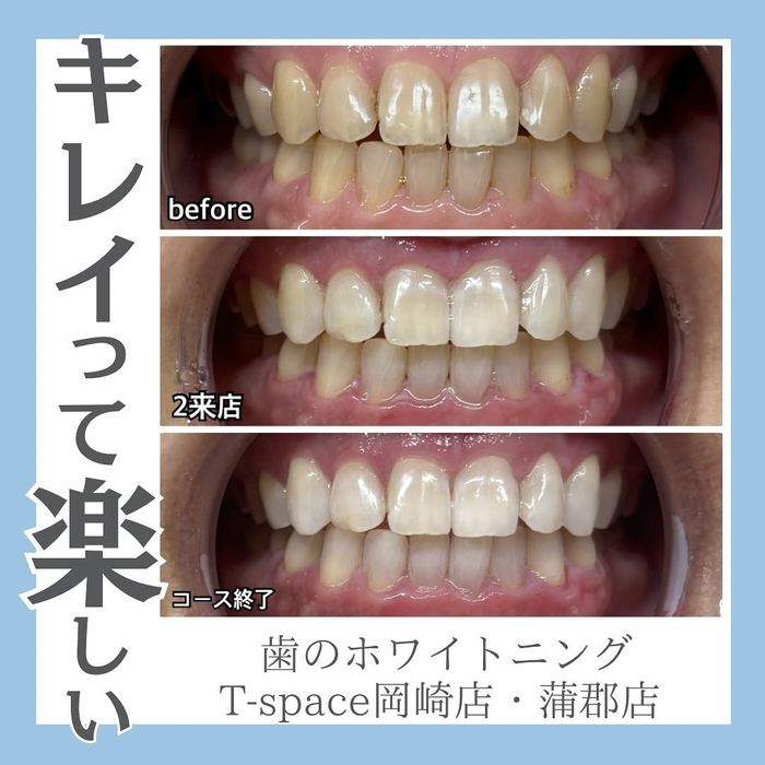 画像1245