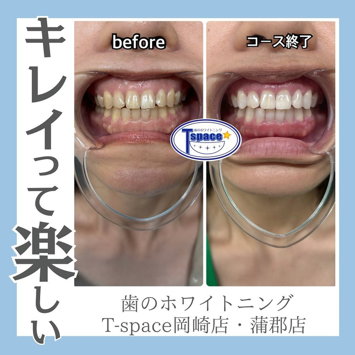 画像1246