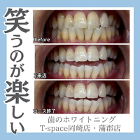 画像1255