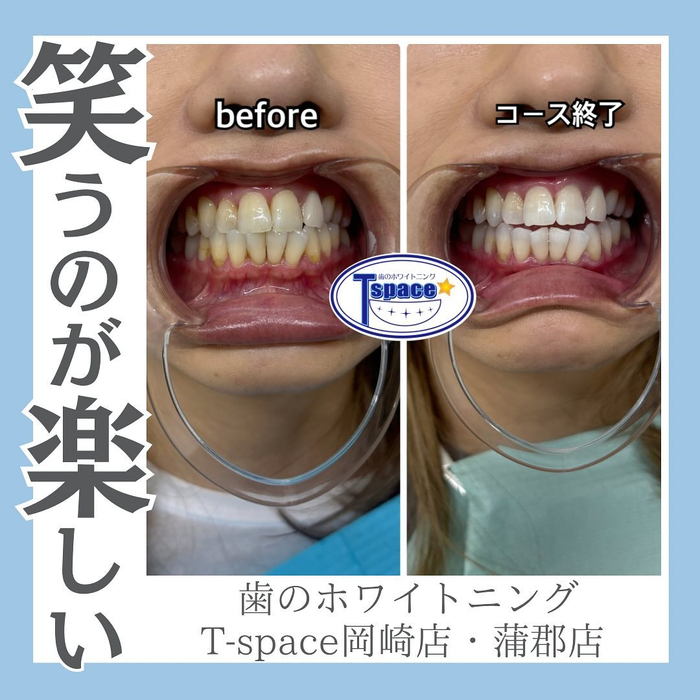 画像1256