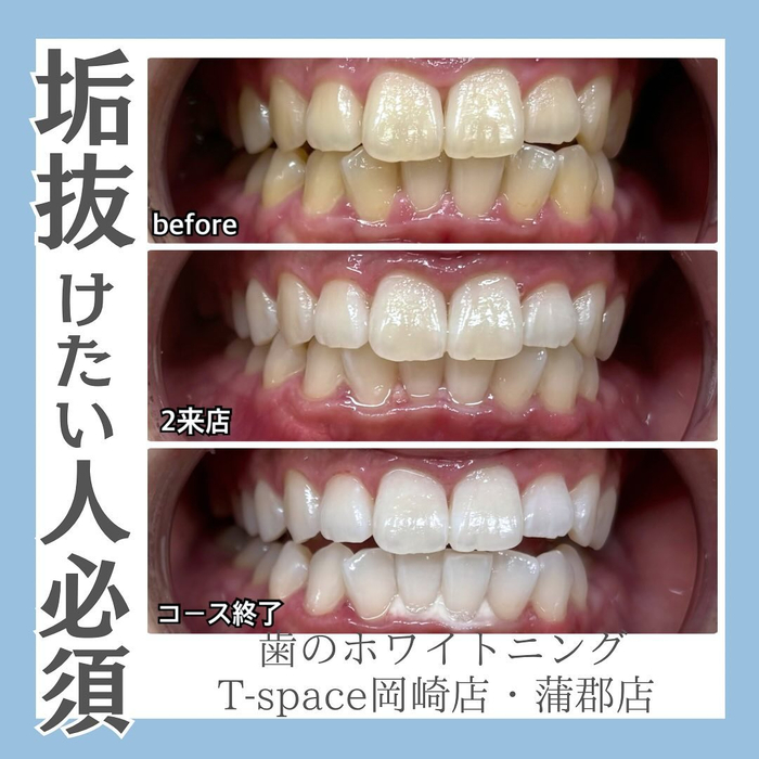 画像1265
