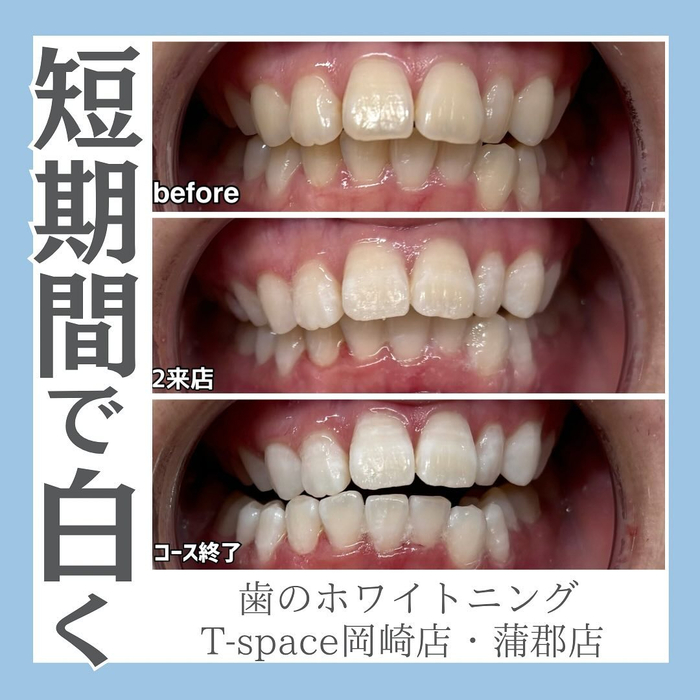 画像1275