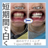画像1276