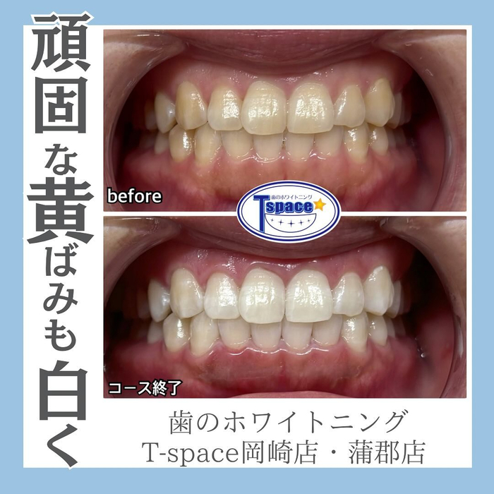 画像1284