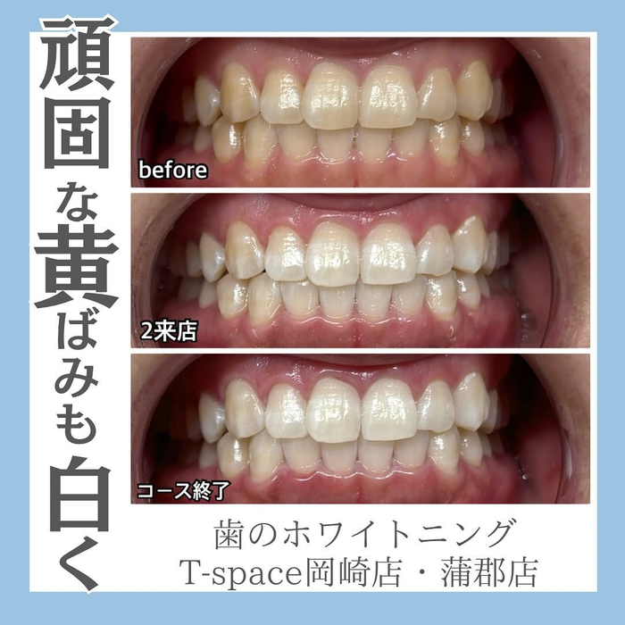 画像1285