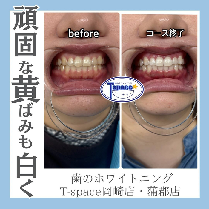 画像1286