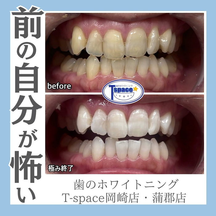 画像1294
