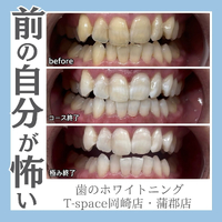 画像1295