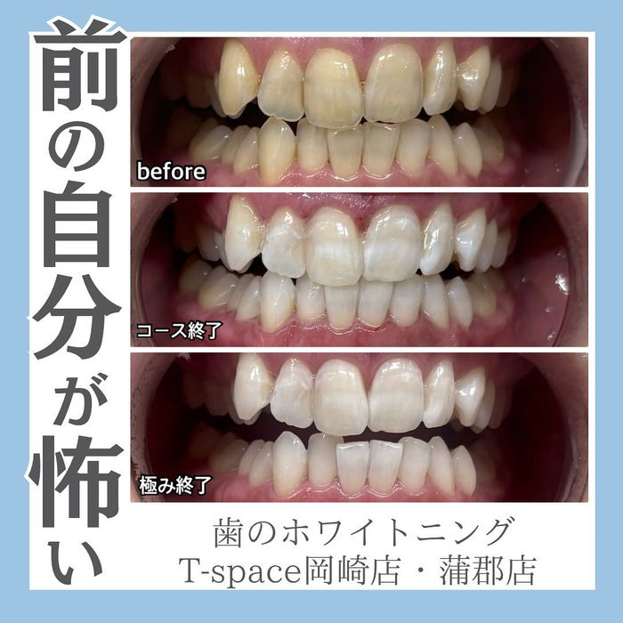 画像1295