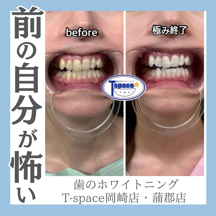 画像1296