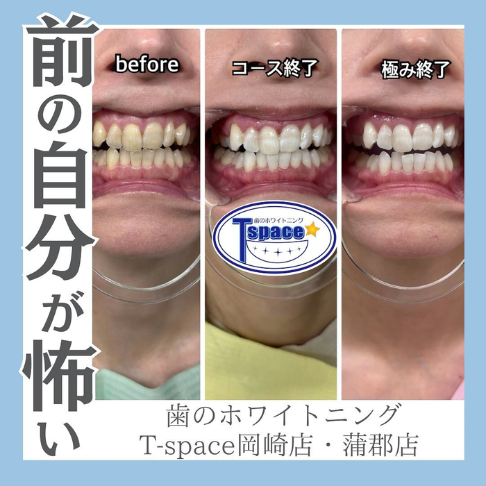 画像1297