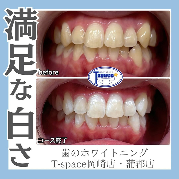 画像1303