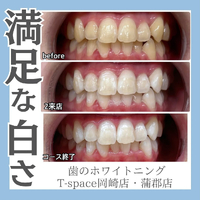 画像1304