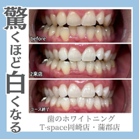 画像1313