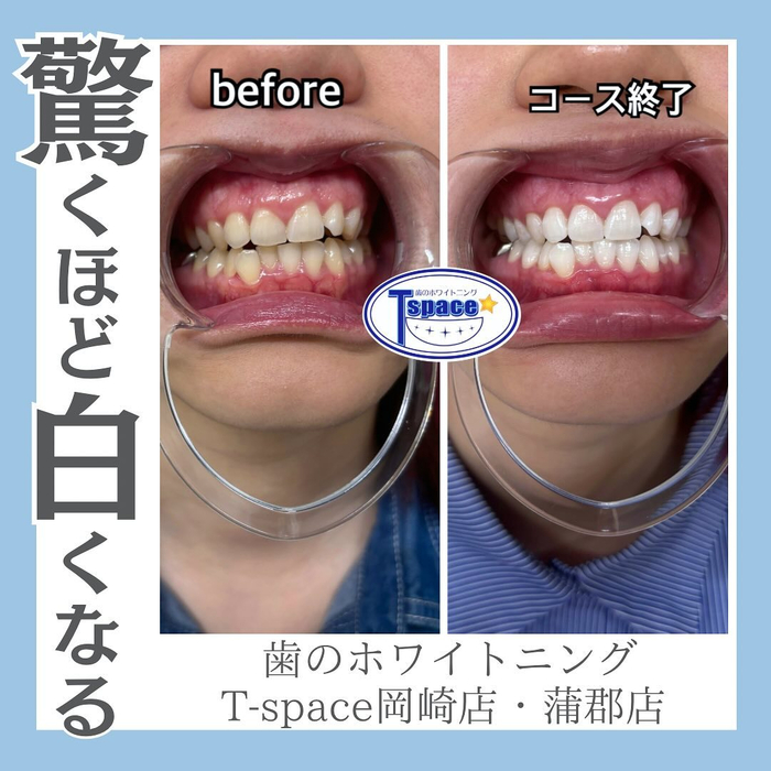 画像1314
