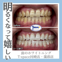 画像1322