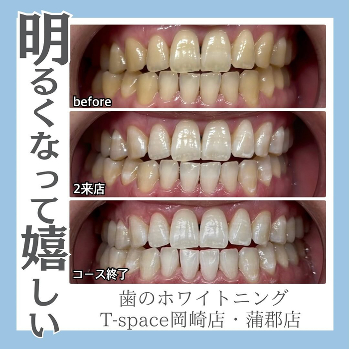 画像1323