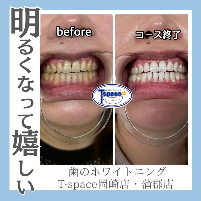 画像1324