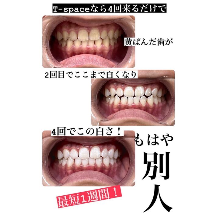 画像261