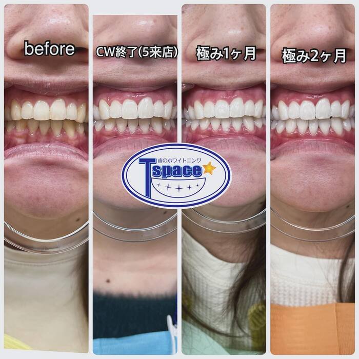 画像332