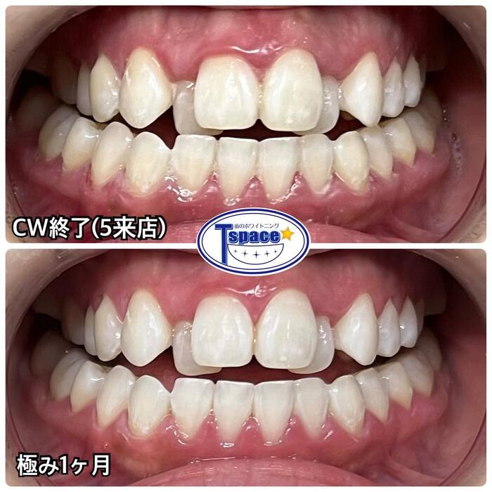 画像335