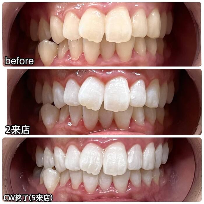 画像345