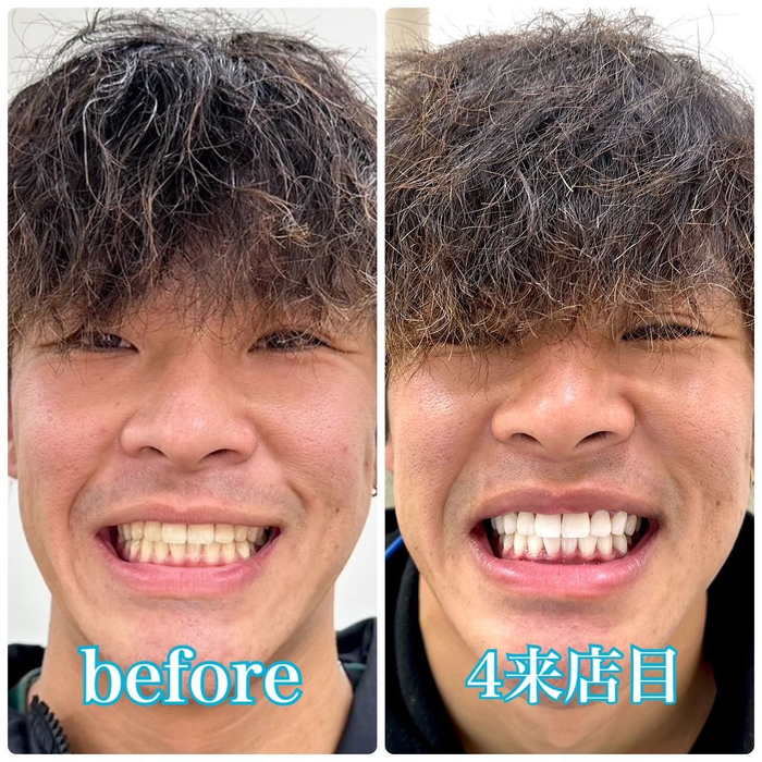 画像360
