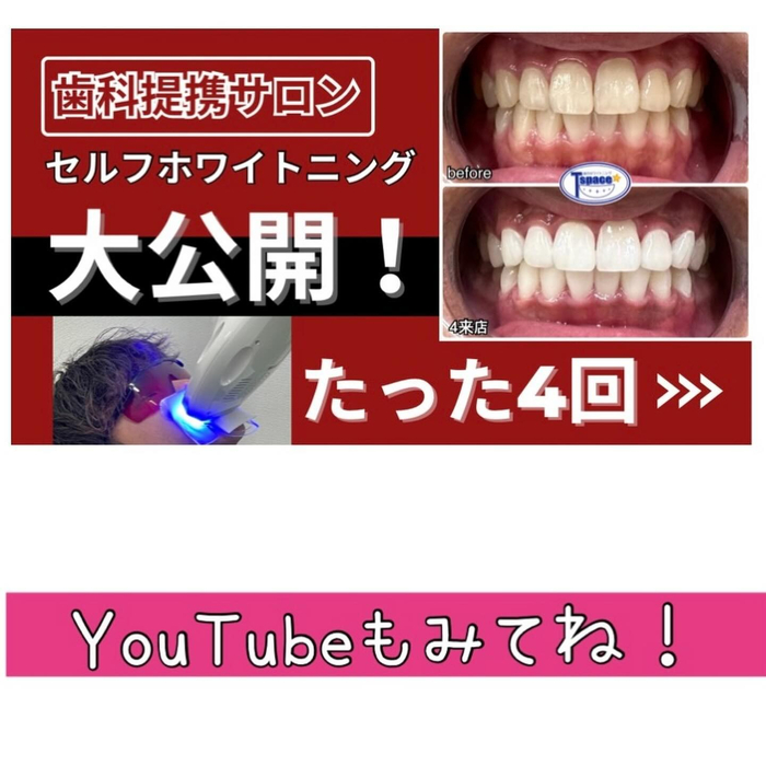 画像361