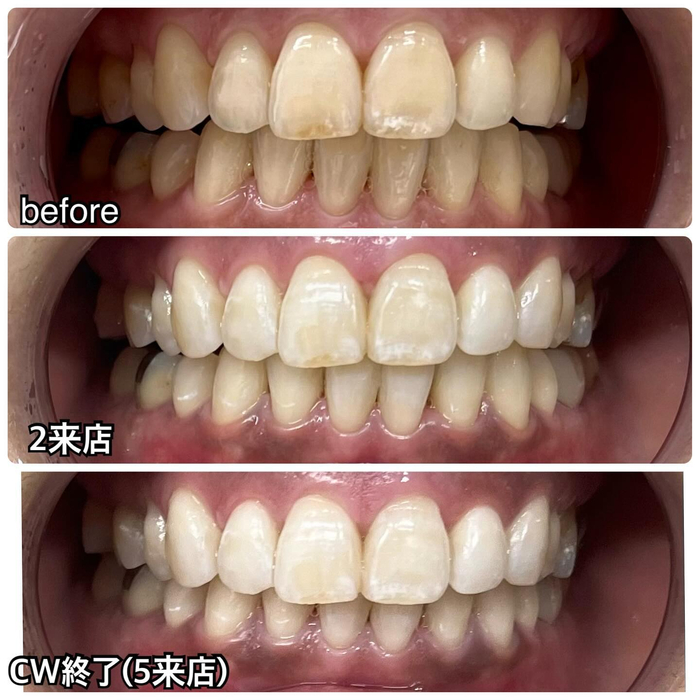画像381