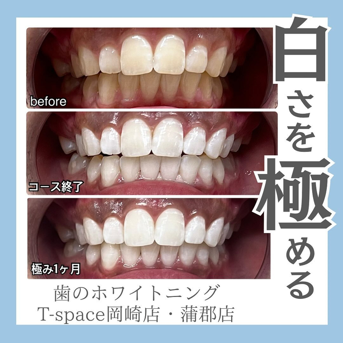 画像414