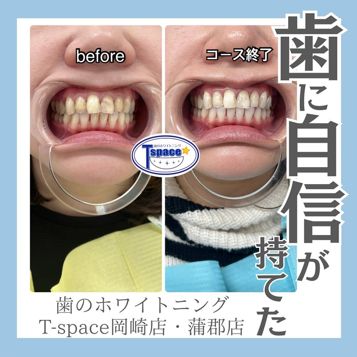 画像421