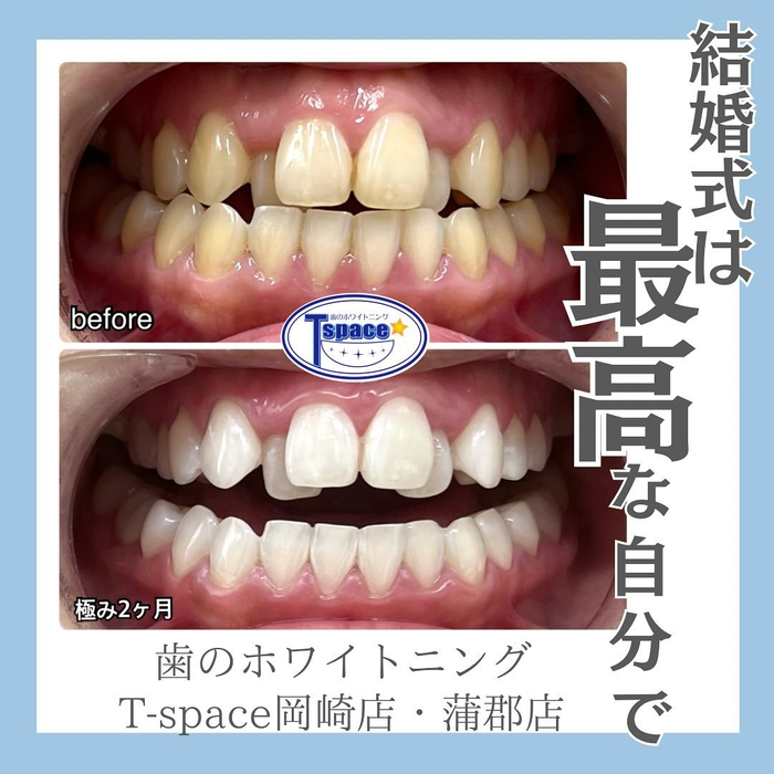 画像425