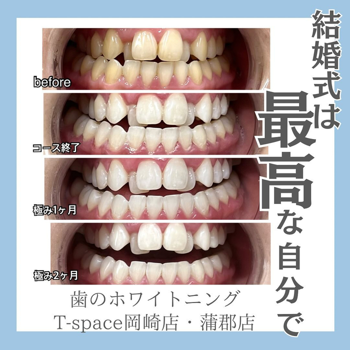 画像426