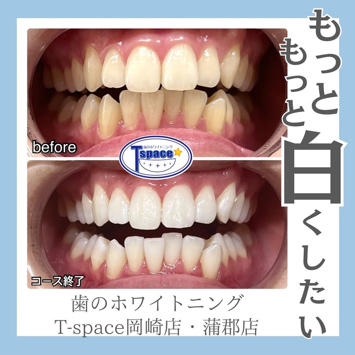 画像431